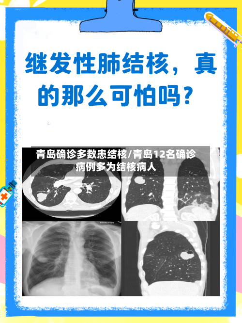 青岛确诊多数患结核/青岛12名确诊病例多为结核病人-第2张图片