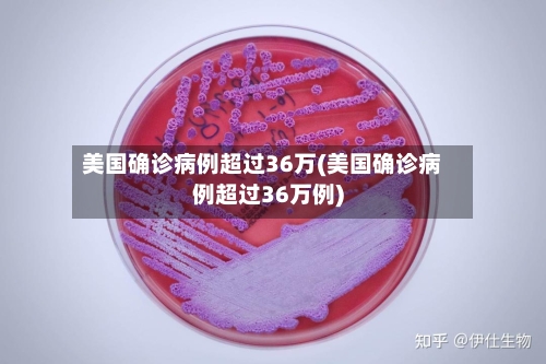 美国确诊病例超过36万(美国确诊病例超过36万例)-第2张图片