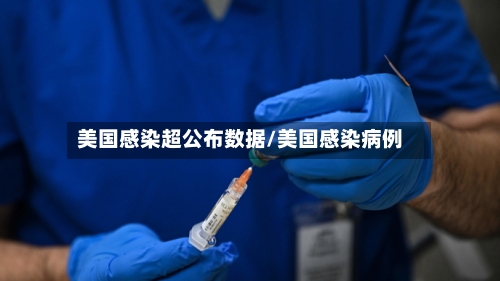美国感染超公布数据/美国感染病例