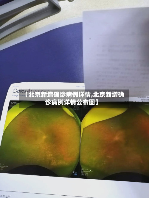【北京新增确诊病例详情,北京新增确诊病例详情公布图】-第2张图片