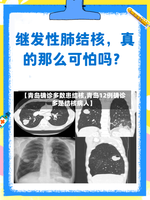 【青岛确诊多数患结核,青岛12例确诊多是结核病人】-第2张图片