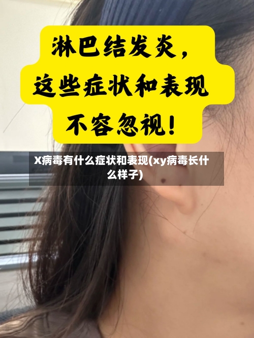 X病毒有什么症状和表现(xy病毒长什么样子)-第2张图片