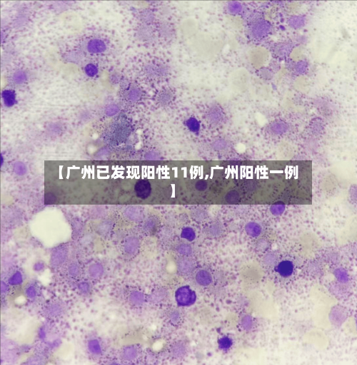 【广州已发现阳性11例,广州阳性一例】-第3张图片