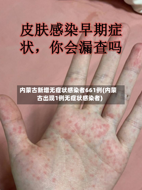 内蒙古新增无症状感染者661例(内蒙古出现1例无症状感染者)