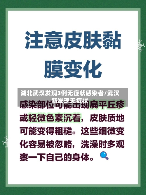 湖北武汉发现3例无症状感染者/武汉新发现无症状-第3张图片