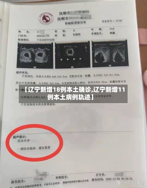 【辽宁新增18例本土确诊,辽宁新增11例本土病例轨迹】-第3张图片