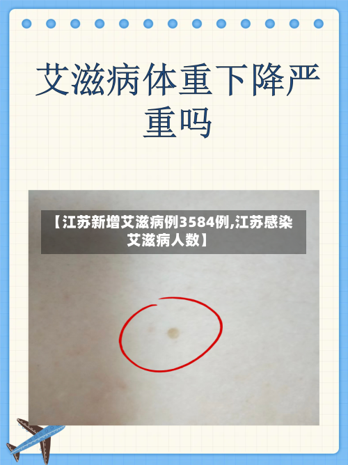 【江苏新增艾滋病例3584例,江苏感染艾滋病人数】-第2张图片