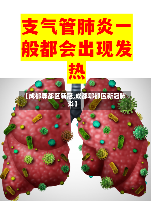 【成都郫都区新冠,成都郫都区新冠肺炎】