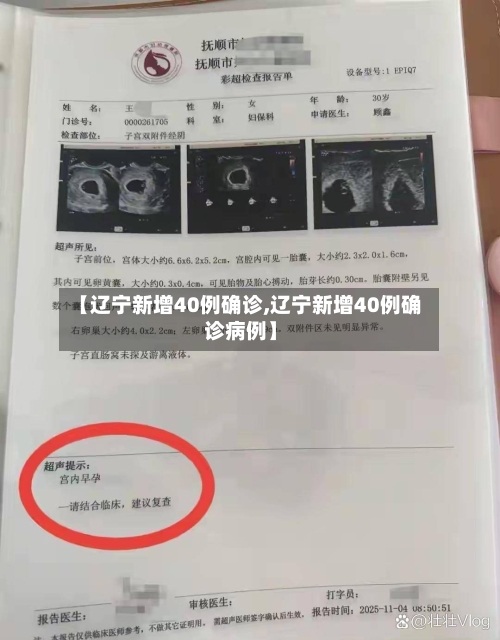 【辽宁新增40例确诊,辽宁新增40例确诊病例】-第2张图片