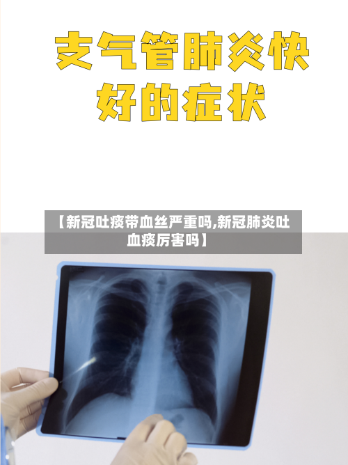 【新冠吐痰带血丝严重吗,新冠肺炎吐血痰厉害吗】