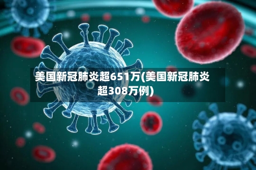 美国新冠肺炎超651万(美国新冠肺炎超308万例)-第3张图片