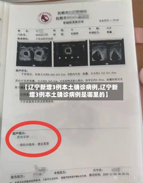 【辽宁新增3例本土确诊病例,辽宁新增3例本土确诊病例是哪里的】-第2张图片