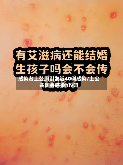 感染者上公厕引发近40例感染/上公共厕会感染hiv吗