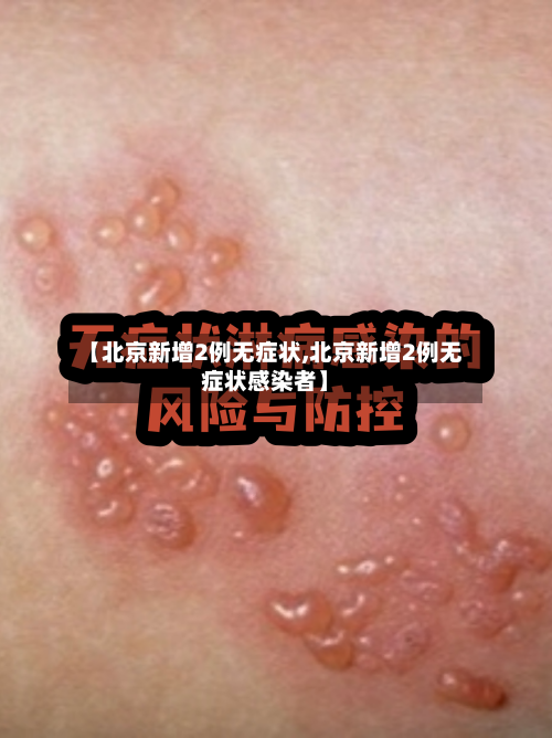 【北京新增2例无症状,北京新增2例无症状感染者】