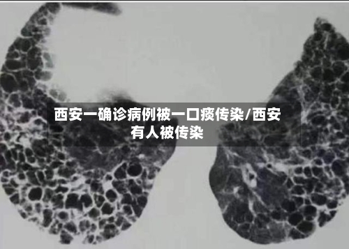 西安一确诊病例被一口痰传染/西安有人被传染