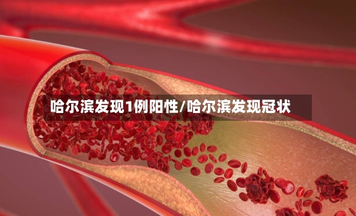 哈尔滨发现1例阳性/哈尔滨发现冠状