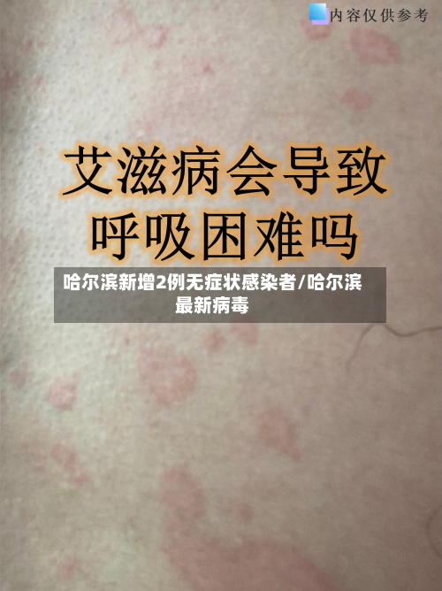 哈尔滨新增2例无症状感染者/哈尔滨最新病毒-第2张图片