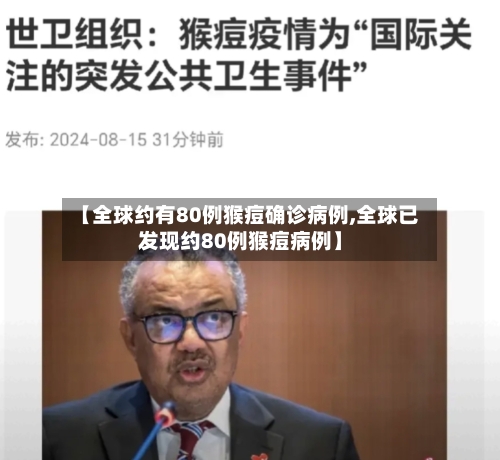 【全球约有80例猴痘确诊病例,全球已发现约80例猴痘病例】-第2张图片