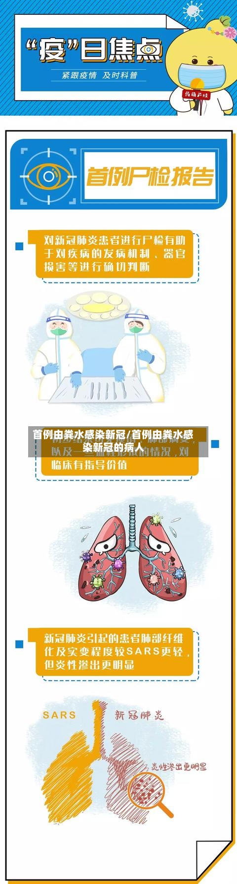 首例由粪水感染新冠/首例由粪水感染新冠的病人-第3张图片