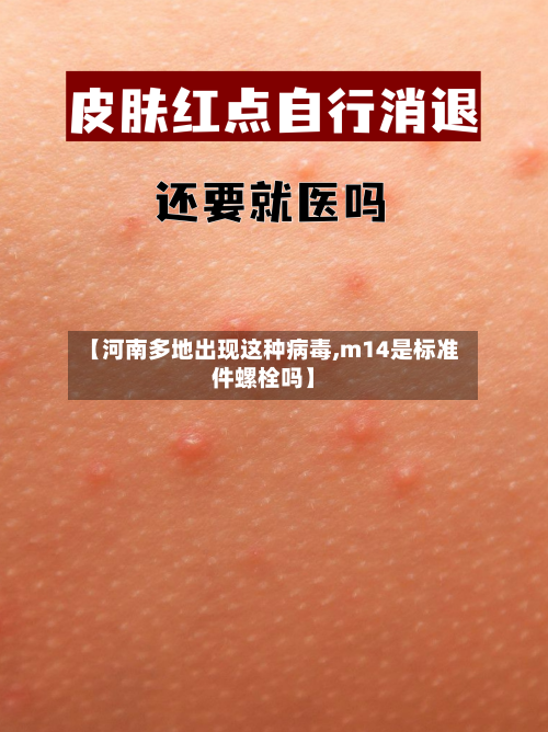 【河南多地出现这种病毒,m14是标准件螺栓吗】