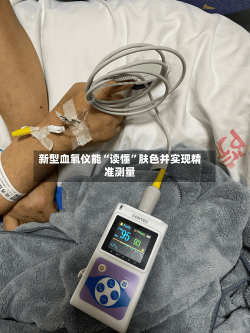 新型血氧仪能“读懂”肤色并实现精准测量