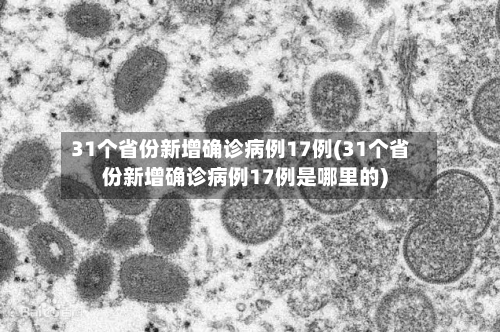 31个省份新增确诊病例17例(31个省份新增确诊病例17例是哪里的)