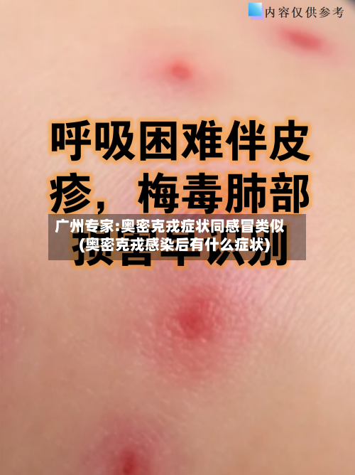 广州专家:奥密克戎症状同感冒类似(奥密克戎感染后有什么症状)-第2张图片