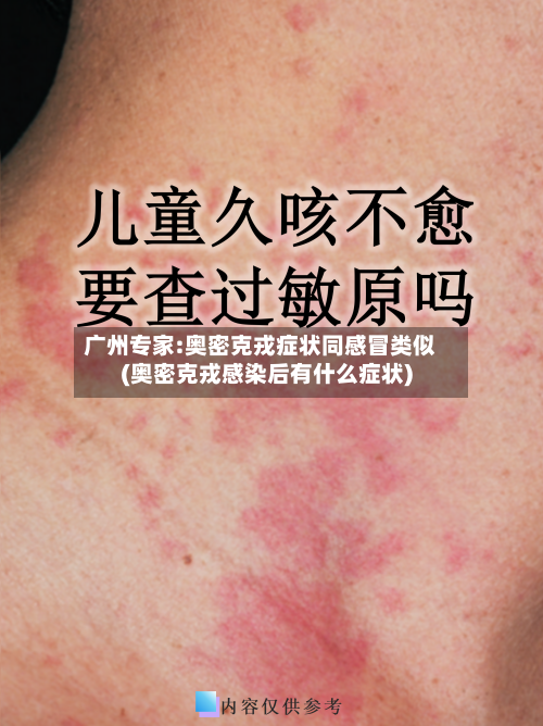 广州专家:奥密克戎症状同感冒类似(奥密克戎感染后有什么症状)