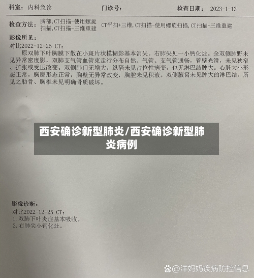 西安确诊新型肺炎/西安确诊新型肺炎病例