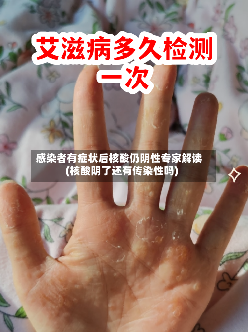 感染者有症状后核酸仍阴性专家解读(核酸阴了还有传染性吗)-第2张图片
