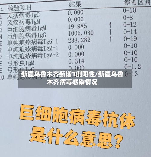 新疆乌鲁木齐新增1例阳性/新疆乌鲁木齐病毒感染情况-第2张图片