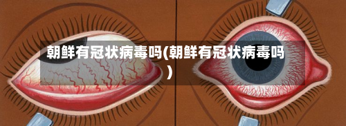 朝鲜有冠状病毒吗(朝鲜有冠状病毒吗)-第2张图片