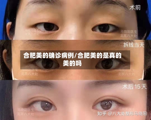 合肥美的确诊病例/合肥美的是真的美的吗-第2张图片