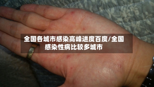 全国各城市感染高峰进度百度/全国感染性病比较多城市-第2张图片