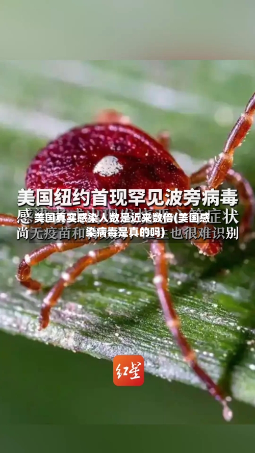 美国真实感染人数是近来数倍(美国感染病毒是真的吗)