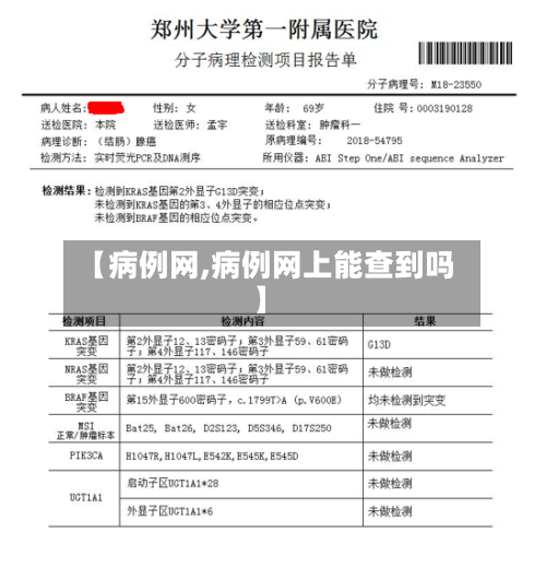 【病例网,病例网上能查到吗】